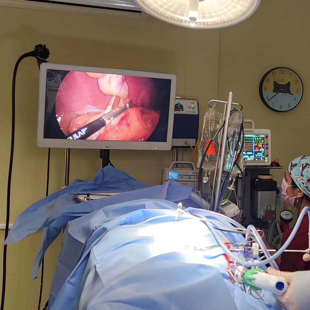 An endoscopy in progress