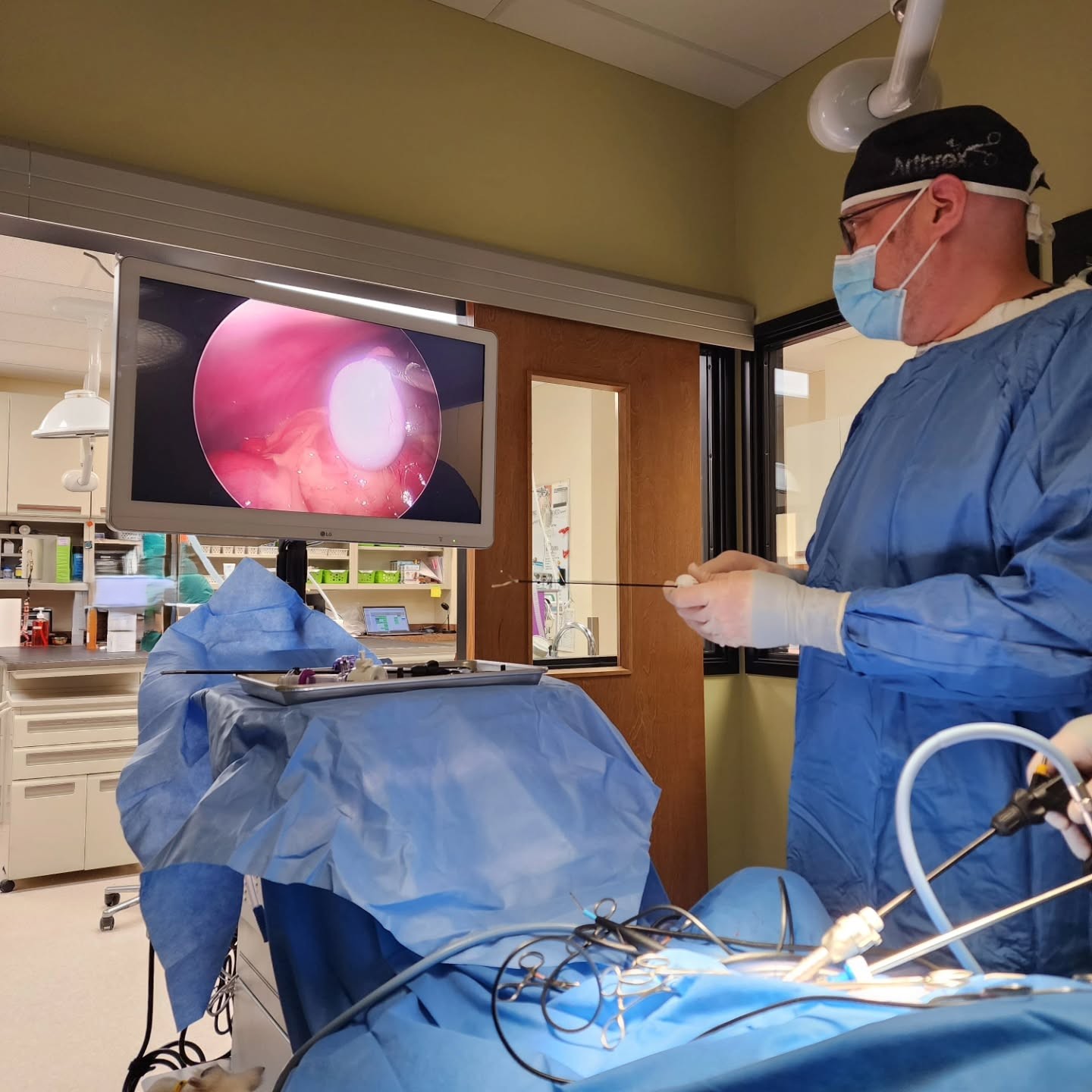 laparscopy treatment