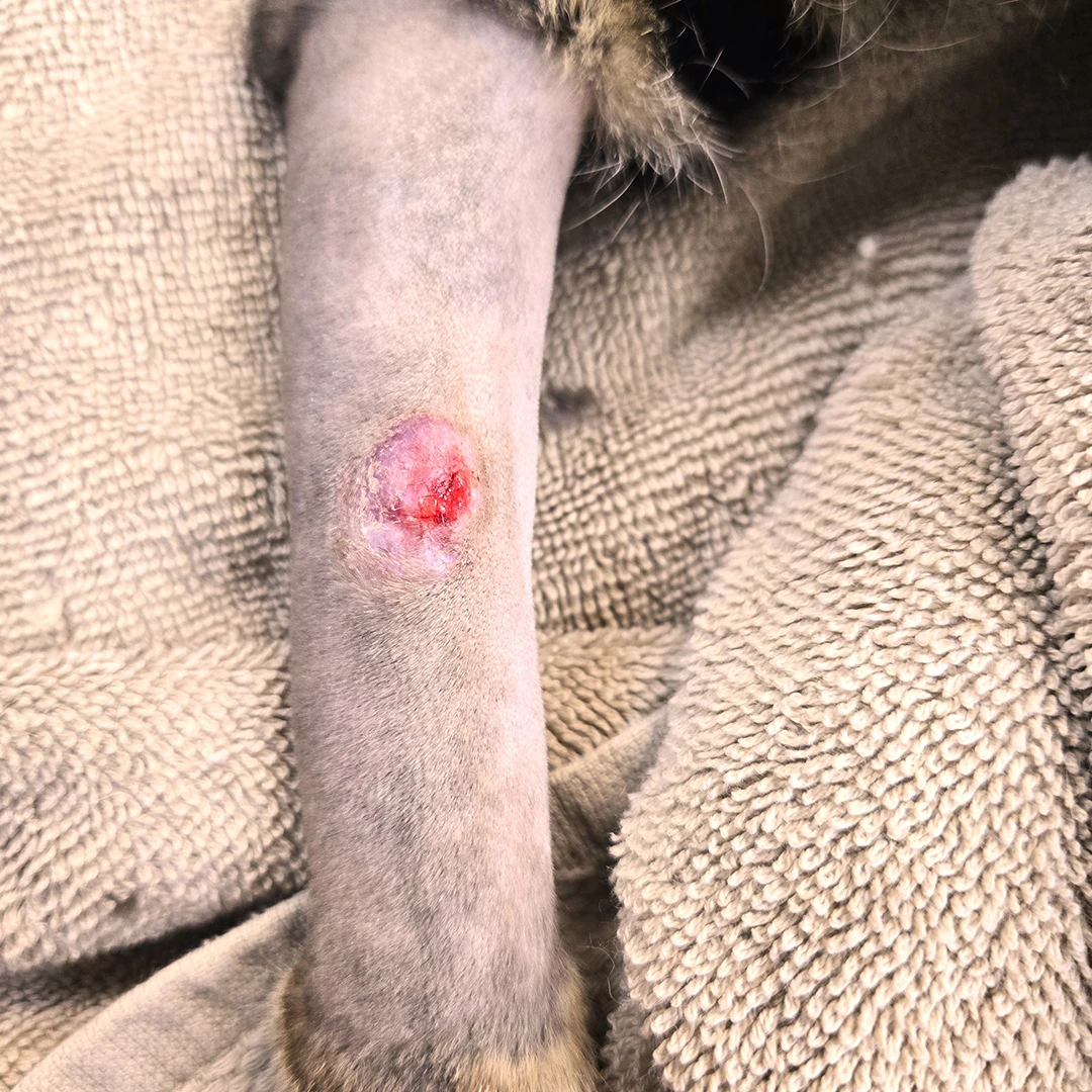 Recovered oncology surgery patient